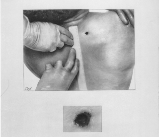 Illustration for article titled Reason for Conspiracy? 5 Mysterious Details From JFK's Autopsy